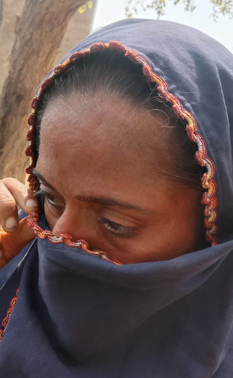 A woman with skin disease.