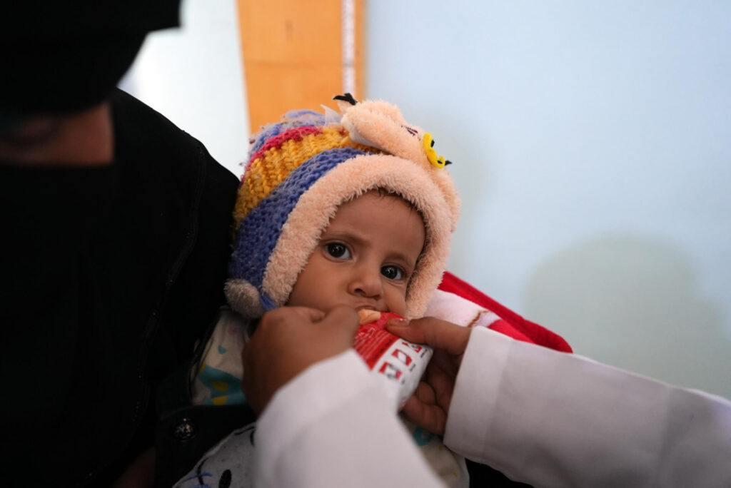 A child eats Plumpy’Nut, a treatment for severe acute malnutrition.