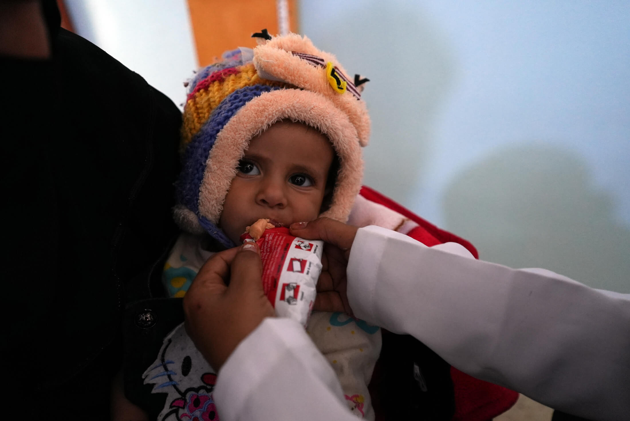 A child in Yemen receives Plumpy’nut, a therapeutic food used to treat malnutrition in children.