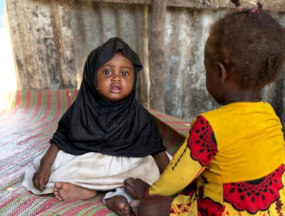 Cimran (left) plays with another child after being discharged from Fanoole Food Distribution Center, where International Medical Corps runs a comprehensive nutrition programme to diagnose and treat malnourished patients.