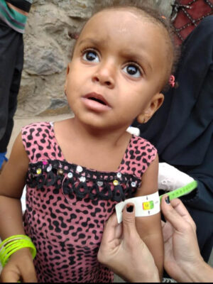A community health and nutrition volunteer (CHNV) measures the mid-upper arm circumference (MUAC) of 4-year-old Fatima, who had acute malnutrition bordering on the severe category.