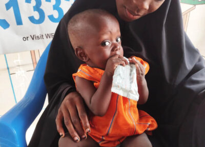 Suleiman eats therapeutic food on his first day of enrollment in our targeted supplementary feeding programme.