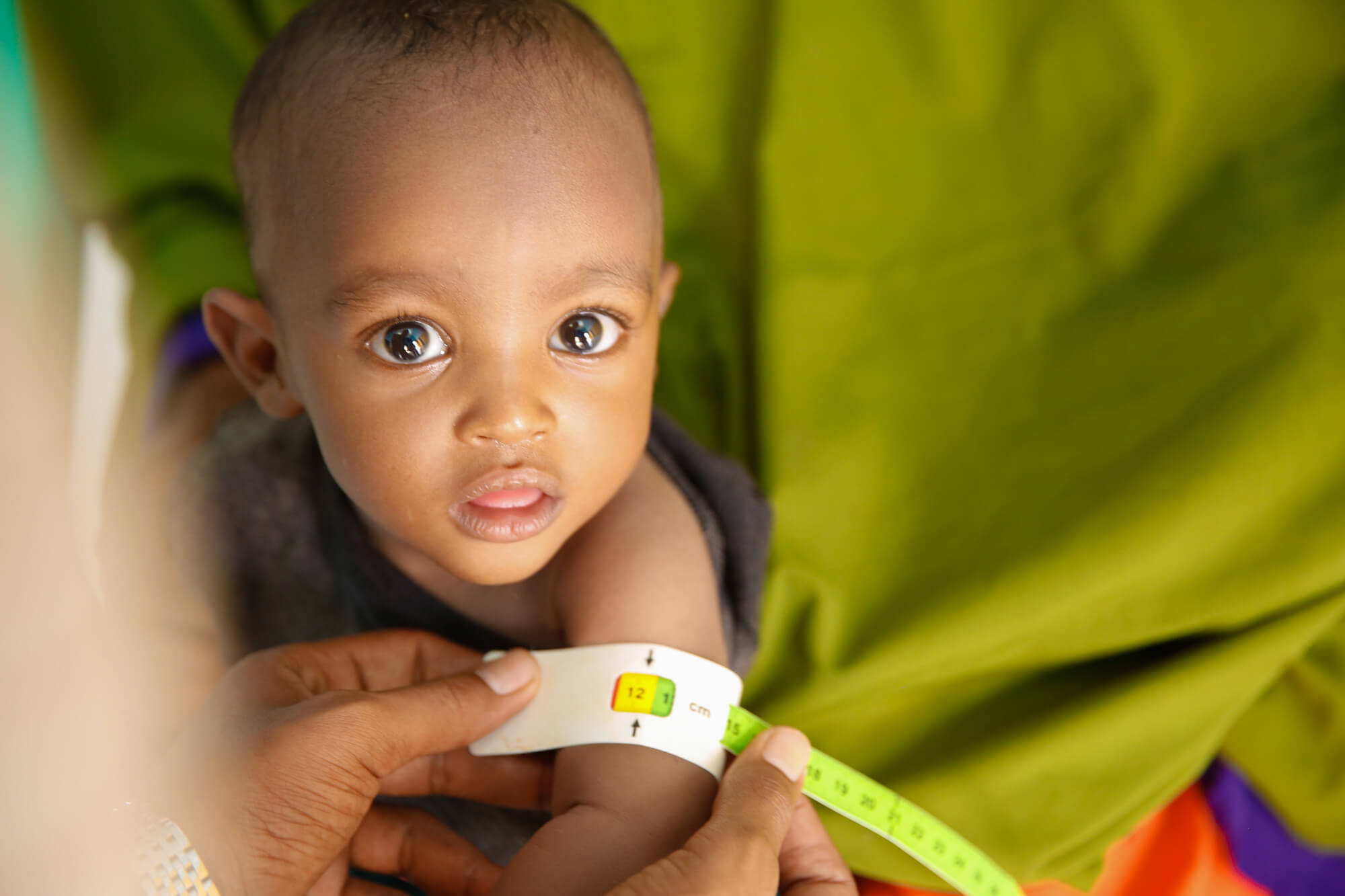 A child with a MUAC reading indicating MAM.