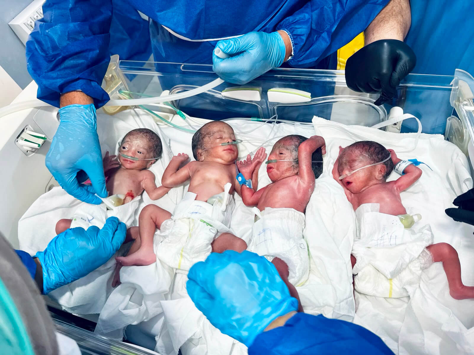 Upon birth, each of the quadruplets received immediate individualised care.